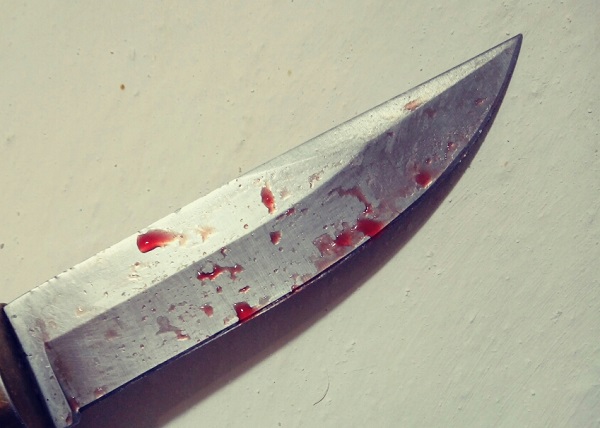 Жительница Бурятии из ревности ударила сожителя ножом в спину